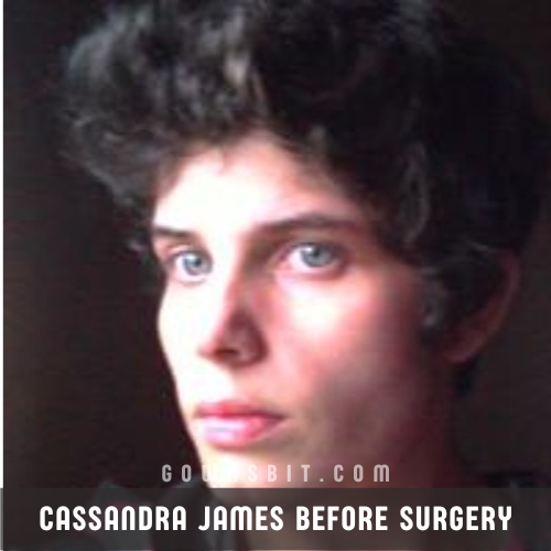 Cassandra James before Surgery Why She Underwent Surgery