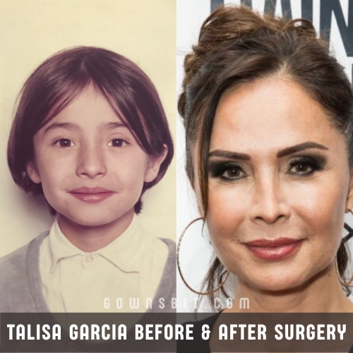 Talisa Garcia before Surgery and Why She Underwent Surgery
