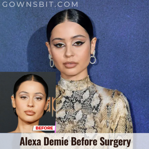 Alexa Demie Before Surgery - Her Net Worth, Career, Age