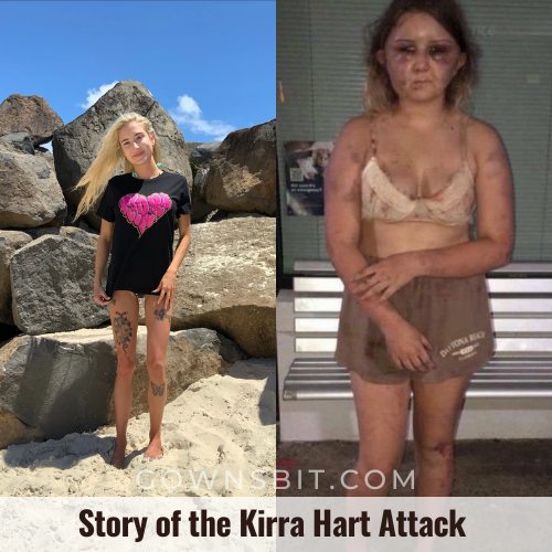 What is the story of the Kirra Hart Attack and Update